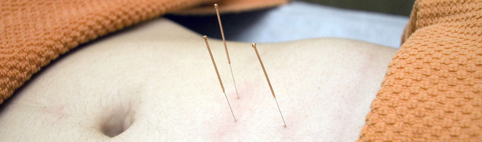 Accupuncture, Eastern Healing Arts in the Bethlehem, Lehigh Valley PA area